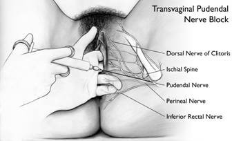 nerve block diagram