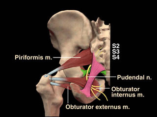 Pudendal Neuralgia