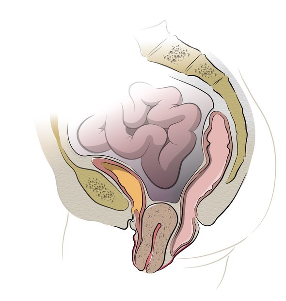 uterus prolapse